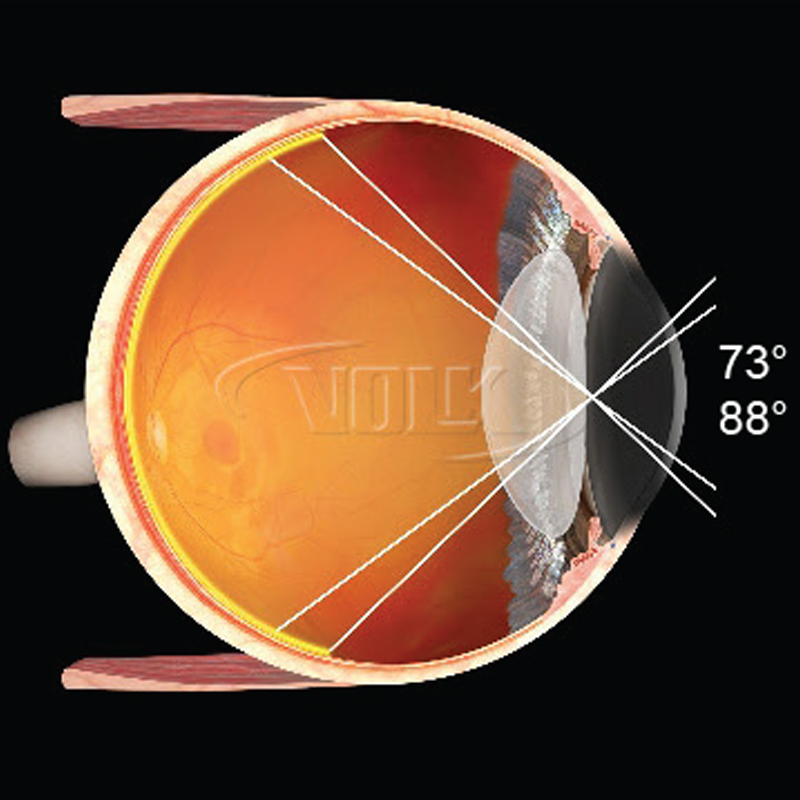 Lente Volk Central Retinal ACS Vitrectomia