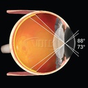 Lente Volk Central Retinal ACS Vitrectomia (copia)