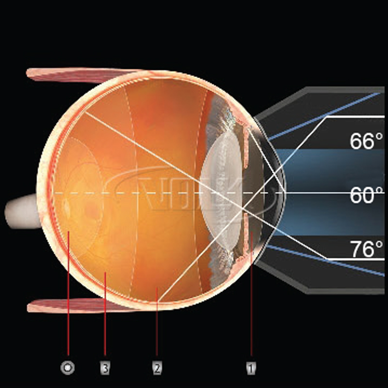 Lente Volk Gonio Fundus AR 3 specchi