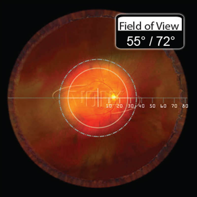 Lente Volk Digital Clear Field