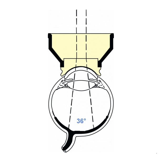 Lente per Fundus