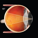 Lente Volk Fundus High Mag SSV Vitrectomia