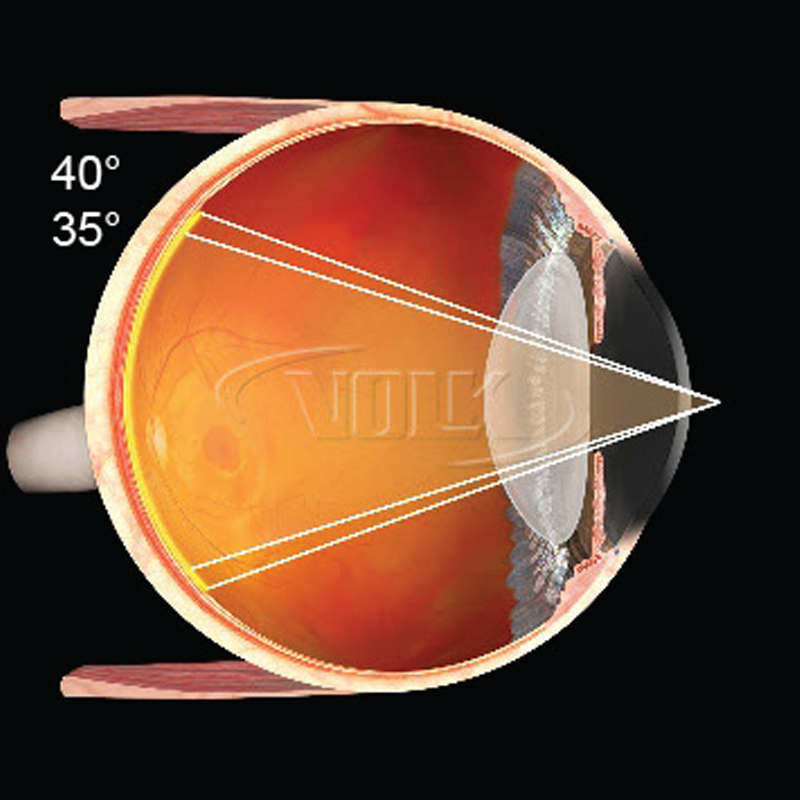 Lente Volk Laser Fundus