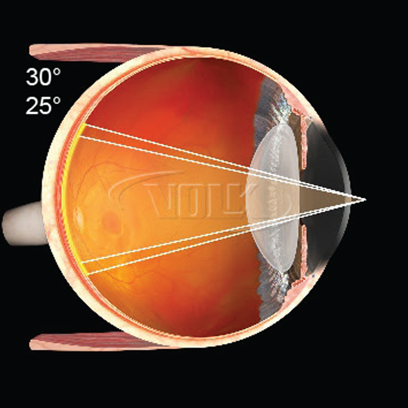 Lente Volk Laser Fundus 20mm