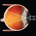 Lente Volk Macula Plus 5,5X