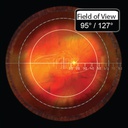 Lente per vitrectomia 156 DynaView