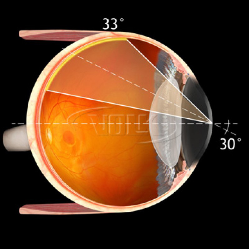 Lenti Volk 30°