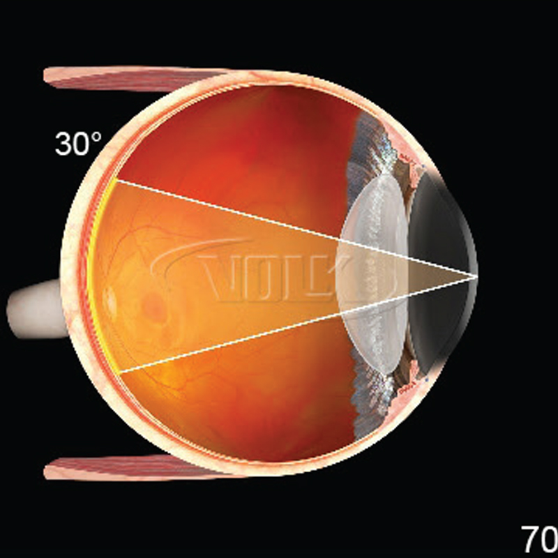 Lenti Volk ingrandenti Central Retina