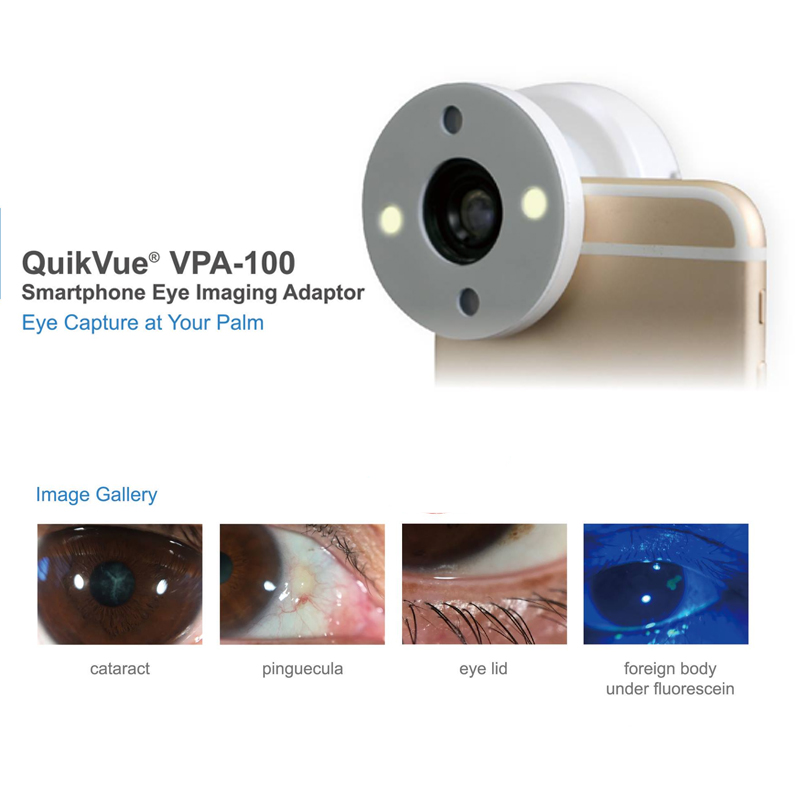 QuikVue Smartphone Eye Imaging