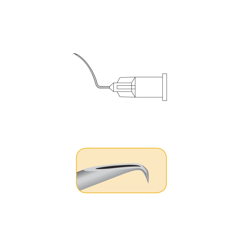 Cannula conformata Capsulotomia - Cistotomo