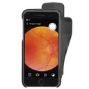 Funduscopio iC2 con cover per iPhone